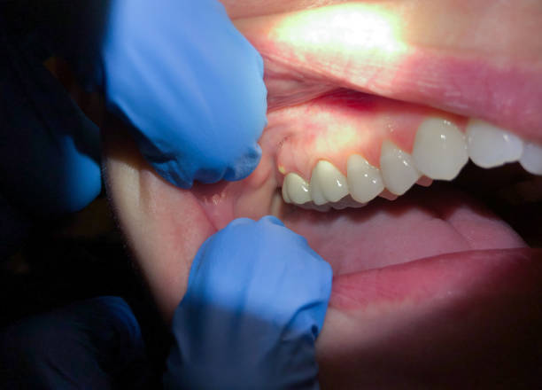 Best Dentist for Dental Trauma  in Fox Lake, IL